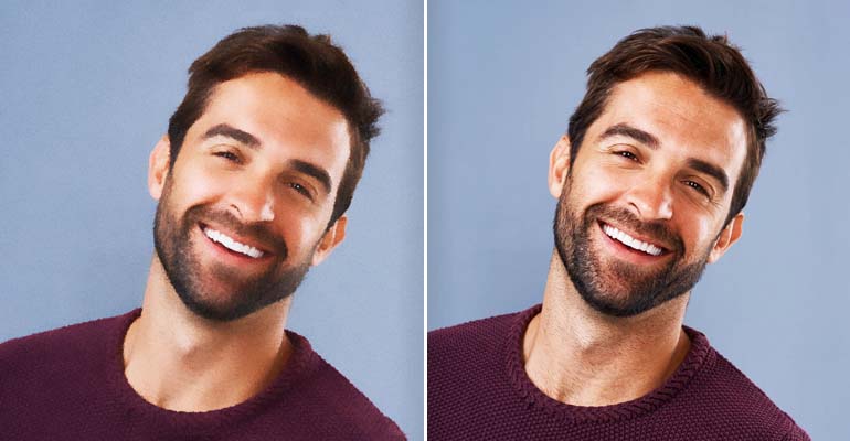 Face Enhancement
